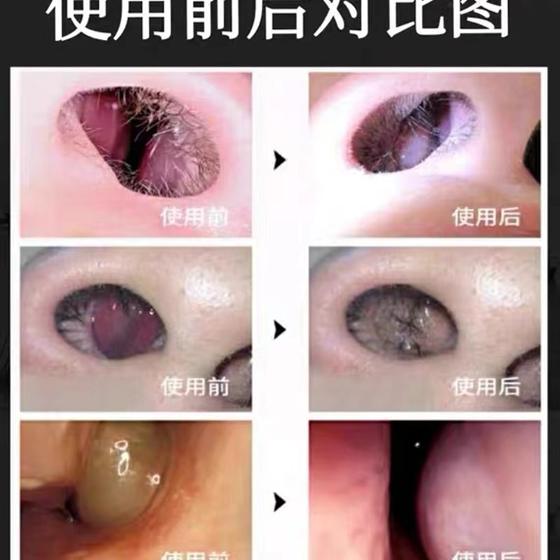 鼻焱膏过敏性鼻焱鼻塞鼻焱神器流鼻涕鼻大上颌窦炎鼻子不通专用膏