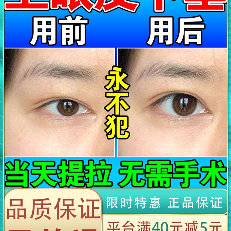 好货眼皮下垂双眼皮神器提拉贴老年人上眼睑松弛紧致大小眼矫正神