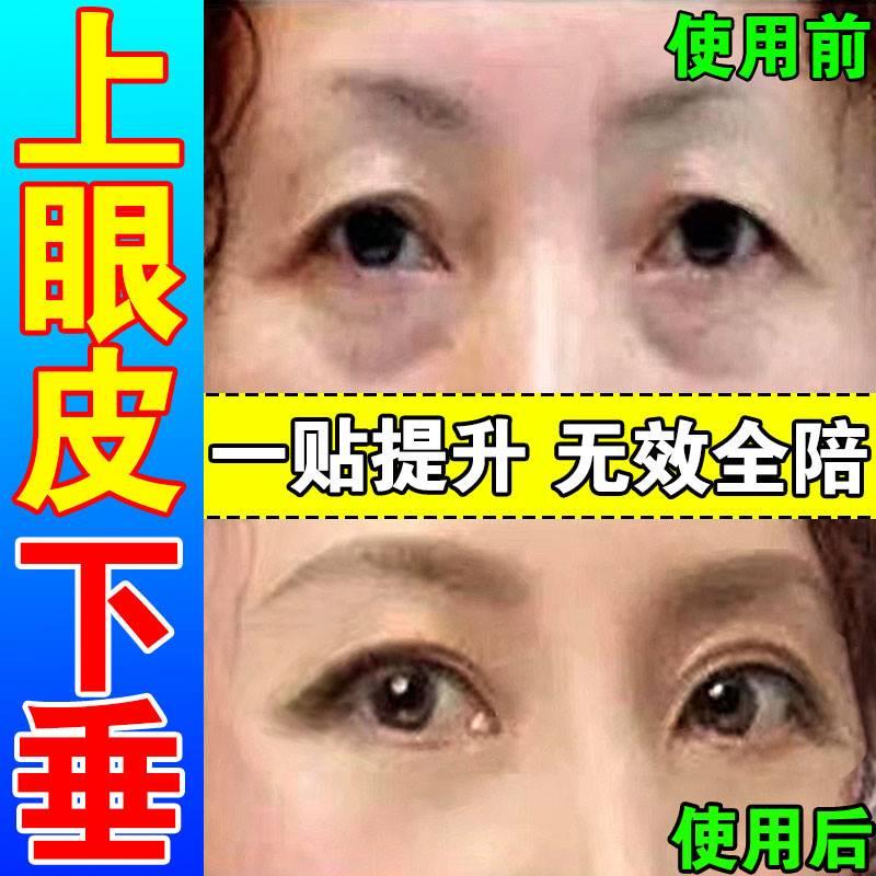 好货上眼皮下垂提升贴双眼皮提拉紧致眼角睑防松弛定型大小眼矫正