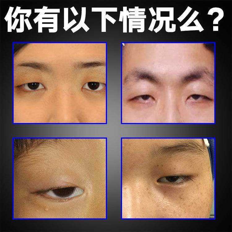 好货双眼皮下垂提拉贴上眼睑下垂去肿眼泡专用定型提拉紧Y致防松