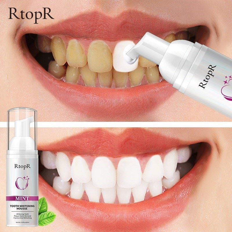 Teeth Cleansing Whitening Mousse Removes Sta Teeth Whitening