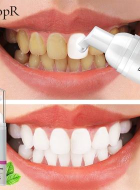 Teeth Cleansing Whitening Mousse Removes Sta Teeth Whitening