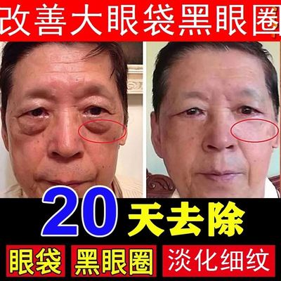 网红好货黑眼圈去除男士专用眼霜去眼袋消浮肿神器眼带霜淡化细纹