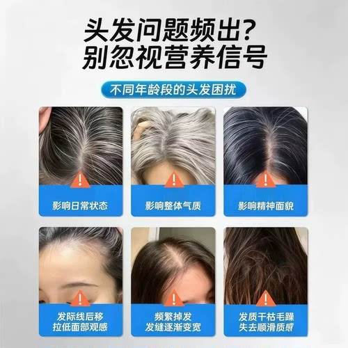 【药房正品】维生素B官方旗舰店黑少中老年发男女专用3LL