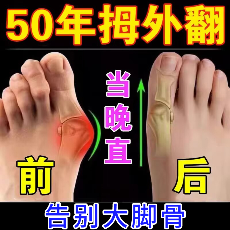 现货速发拇外翻贴【一贴矫正】拇指外翻矫正器大脚骨变形脚趾重叠