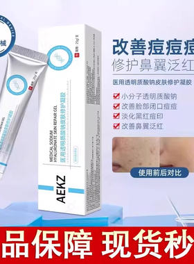 AEKZ修复凝胶vvev凝胶祛痘印闭口透明质酸钠消痘痘修护凝胶脂溢性