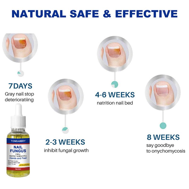 Nail Fungal Treatment Feet Care Essence Against Fungal Nail