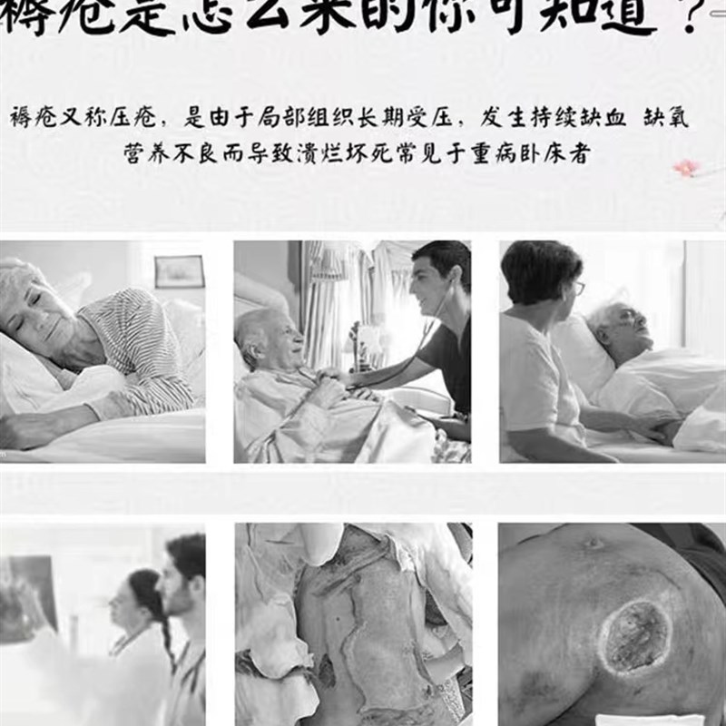 极速伤口癒合快速结痂生肌膏擦伤烫伤烧伤止血外用膏术後去腐生肌