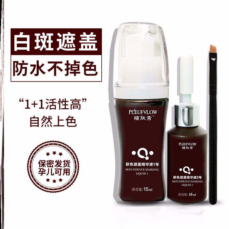 极速白斑遮盖笔白斑薬膏快速消专用外用黑色素生长液脸部家用