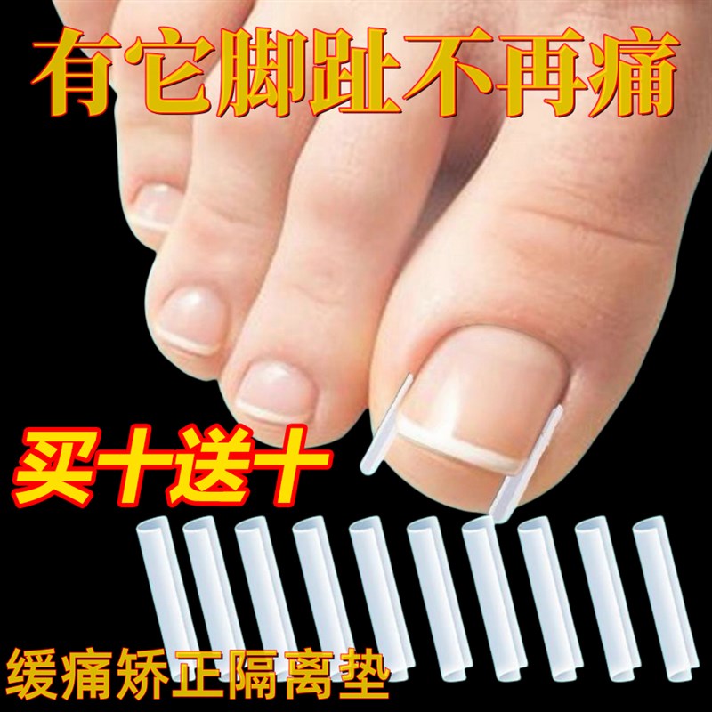 速发甲沟炎矫甲神器指甲里甲隔离填充垫片脚趾正往肉嵌长纠正甲贴