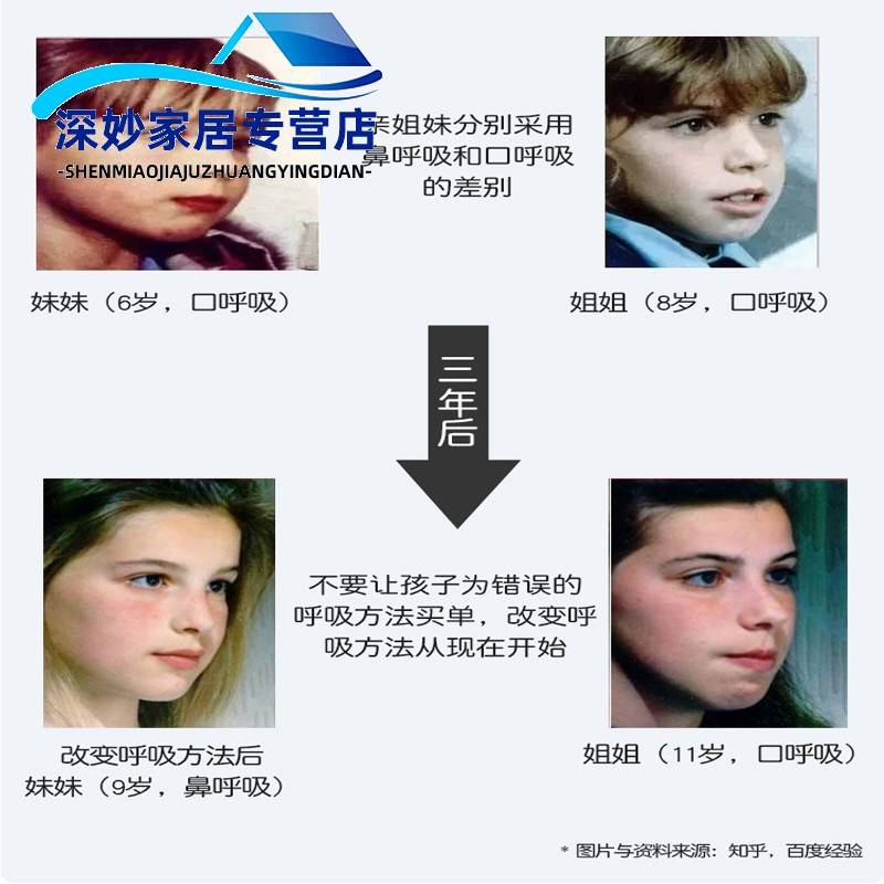 口呼吸矫正器闭嘴神器睡觉防张嘴防止嘴巴张口闭口儿童成人闭嘴带