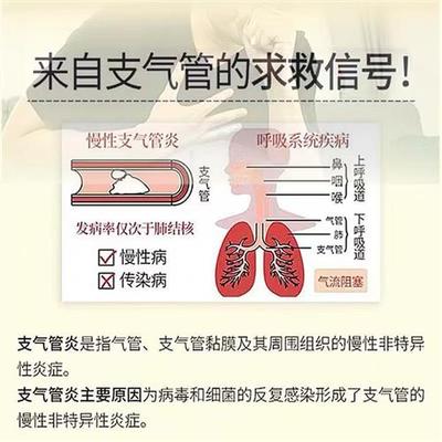 极速支气管咳喘阿斯美复方甲氧那明胶囊60粒苏黄止咳胶X囊24粒扬