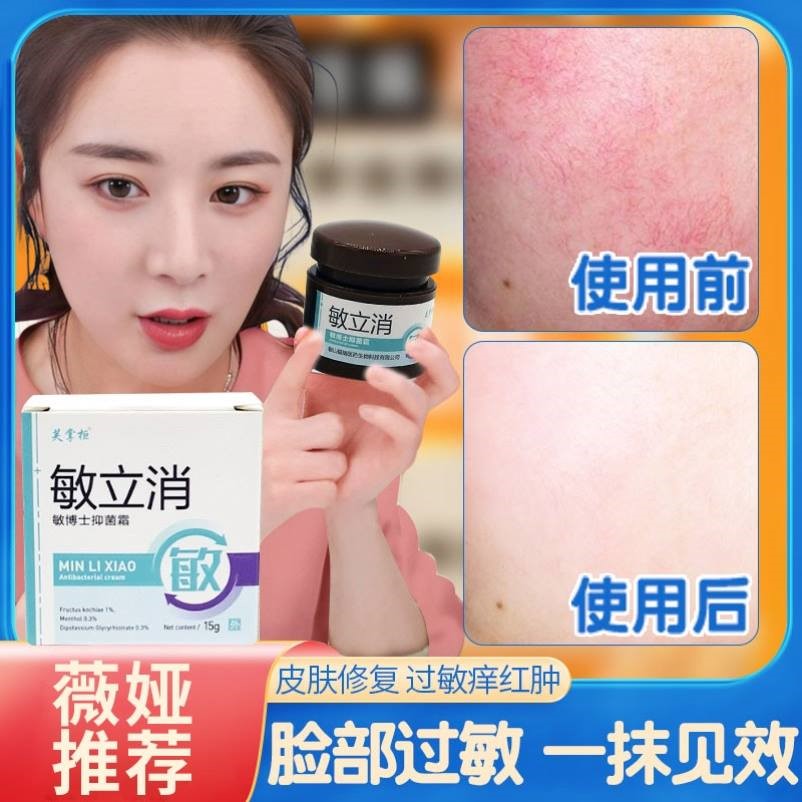 脸部过敏皮肤修复过敏痒红肿红血