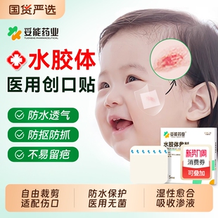 妥能水胶体敷料人工皮湿性愈合伤口创可口贴摔烫伤痘痘贴防水无菌