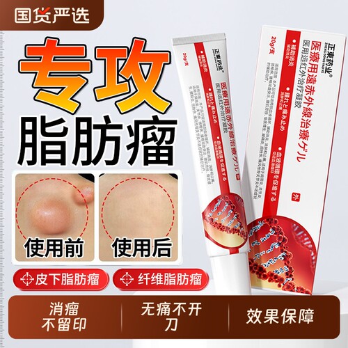 远红外治疗凝胶脂肪瘤包消除膏去除神器纤维皮脂腺囊肿硬结节健康