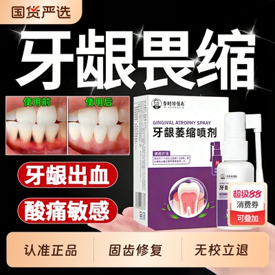 【正品保障】牙龈萎缩喷剂