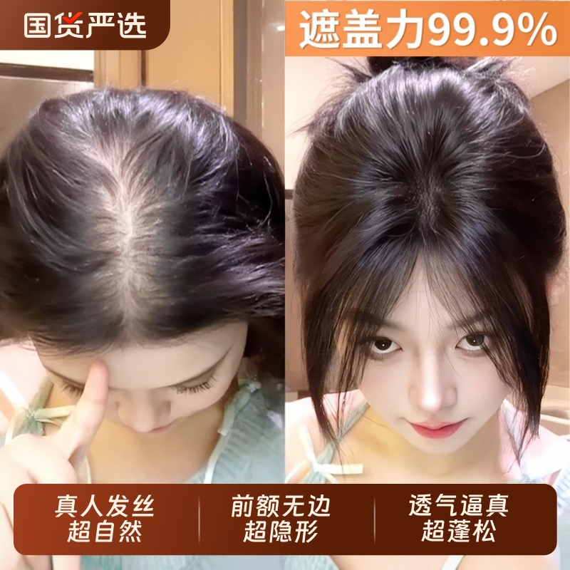 自然隐形前额补发片|206人收藏