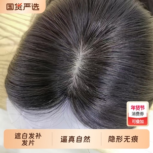 假发片女头顶自然前额量蓬松高颅顶八字刘海真发遮白发补发片胎毛