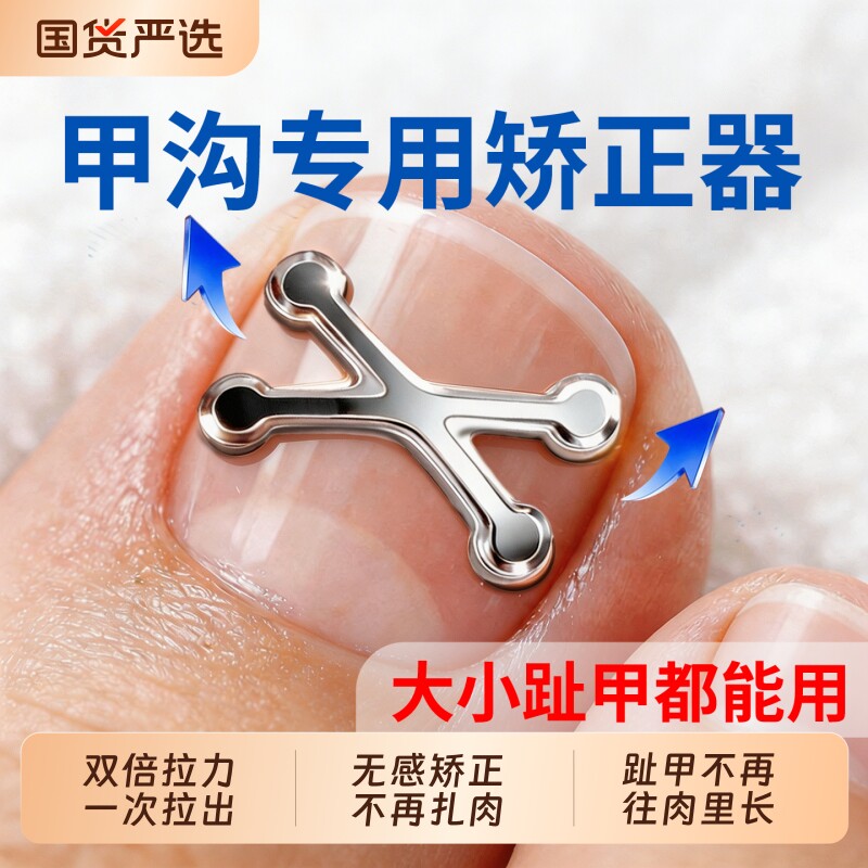 甲沟矫正器嵌指甲盖往肉里长专用合贴片纠脚趾神卷金炎套装钛工具