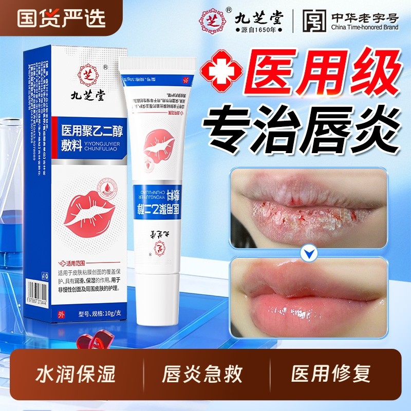 九芝堂唇炎唇膏嘴唇干裂脱皮专用保湿滋润去死皮医用型修护润唇膏