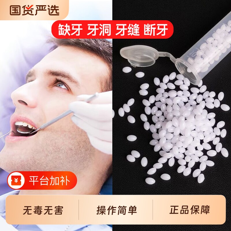 补牙材料树脂牙齿自己在家牙缝洞神器填充膏假牙牙套自补修补临时