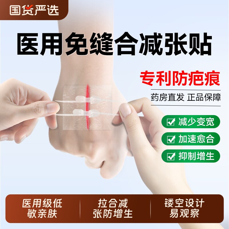 妥能医用伤口减张器创口贴免缝针拉链式弹性愈合剖腹产儿童防疤痕