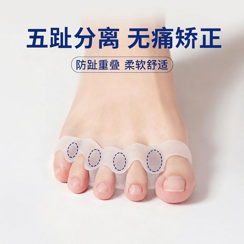 脚趾分趾器无痛矫正不伤骨