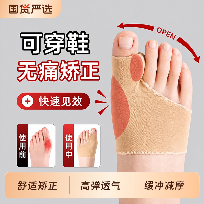 拇指外翻矫正绑带款神器图片