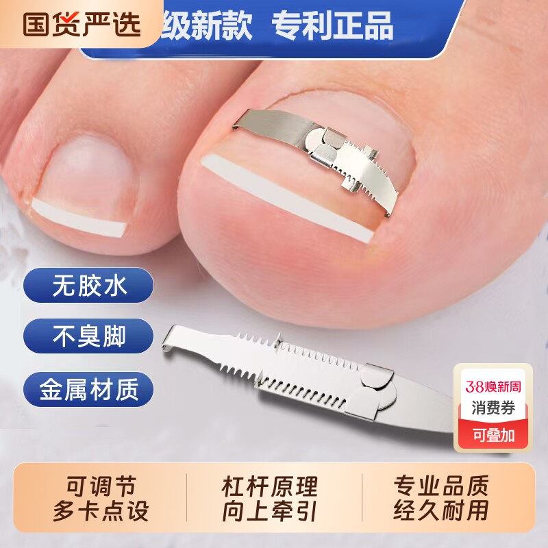 甲沟矫正器嵌甲矫正器脚趾甲卷指甲扎肉纠正神器正甲扣炎正甲贴片
