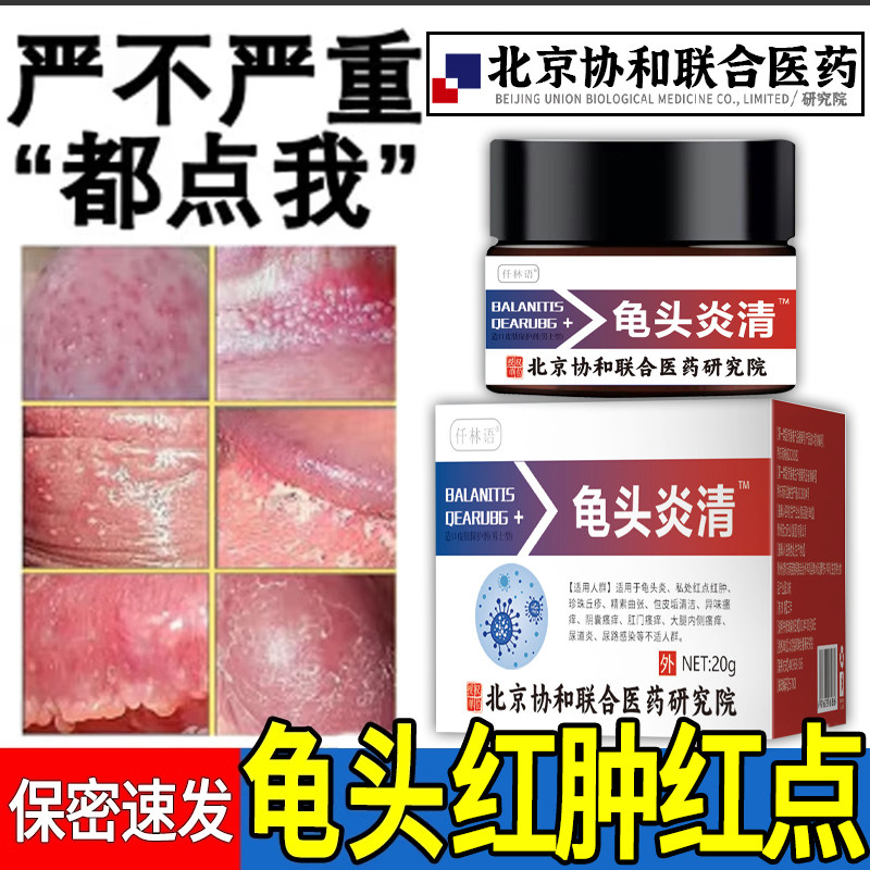 龟头上有小红点斑红肿裂口脱皮炎症瘙痒真菌感染霉菌性白垢包皮xq