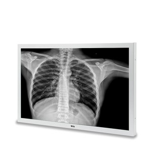 T系列27寸4K医用显示器 多接口选择 支援3840X21O60解析度