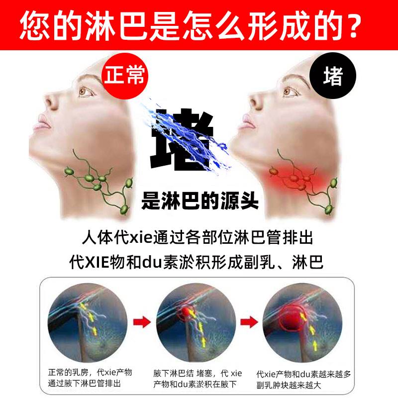 极速淋巴结消膏淋k巴贴散结膏收副乳疏通消除神器消颈耳后腋下结