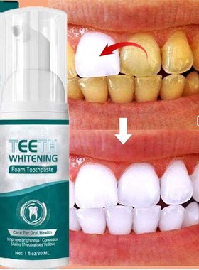 极速Teeth Whitening Mousse Dental Care Essence RemoVve Plaqu