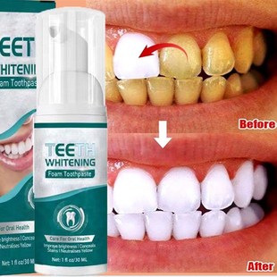 极速Teeth Whitening Mousse Dental Care Essence RemoVve Plaqu