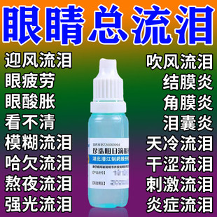 治迎风流泪眼药水止痒消炎杀菌眼睛干涩怕光流眼泪眼睛痒红肿胀痛