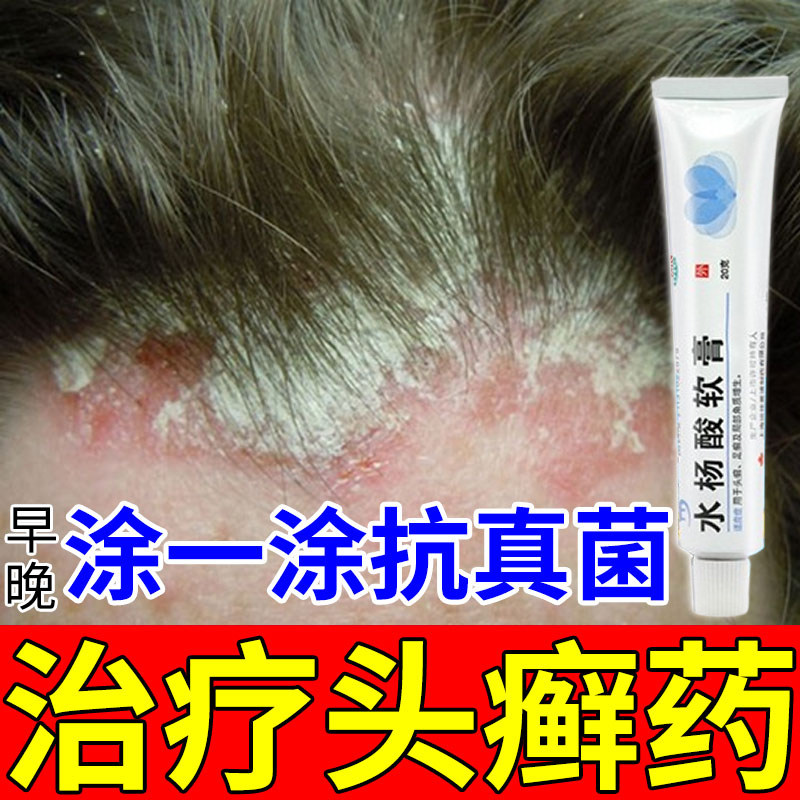 水杨酸软膏正品头癣药膏治头部头癣银屑癣真菌感染头痒头皮红疹