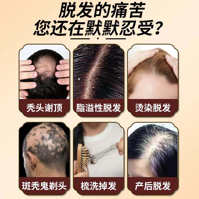 极速阳后脱发严重男女q士专用防掉头发增发密发神器鬼剃头药斑秃