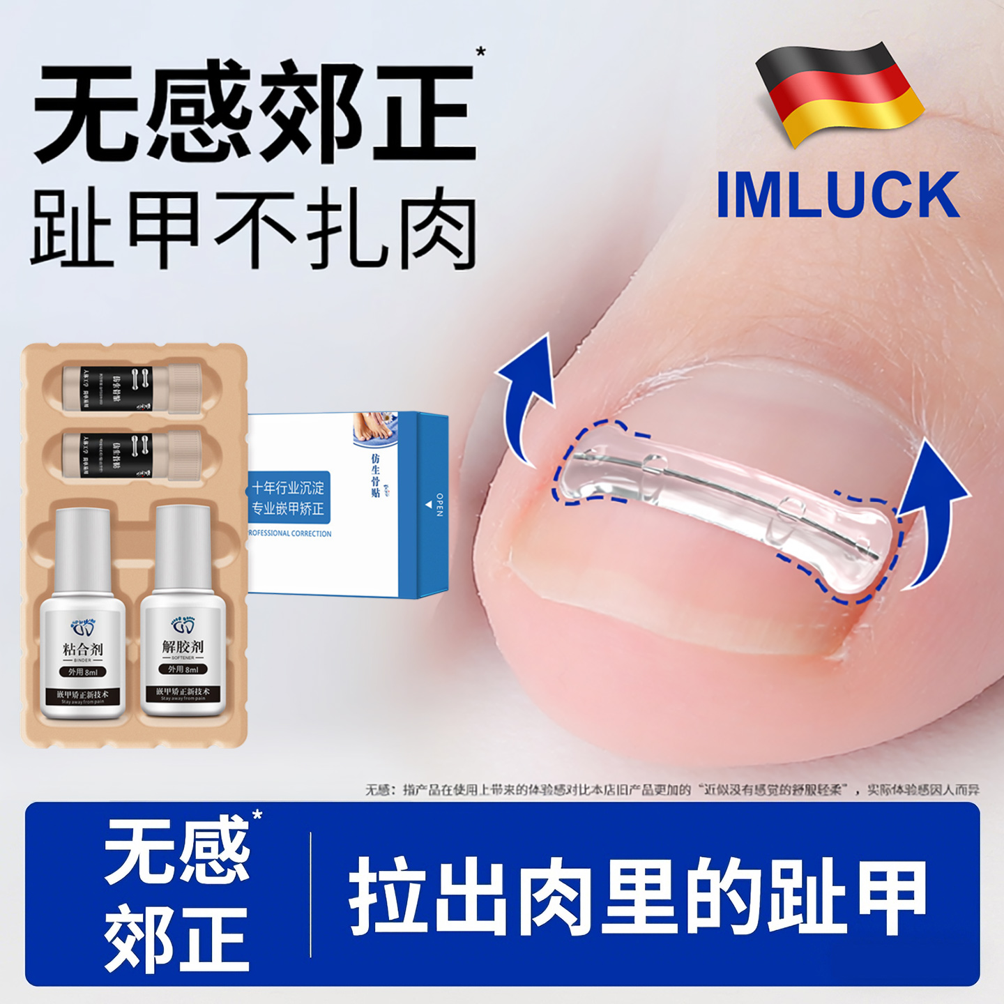 甲沟矫正器炎嵌甲贴片正甲贴纠正脚趾指甲往肉里长专用工具指甲刀