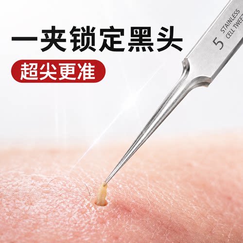 高精密不锈钢黑头粉刺夹镊子