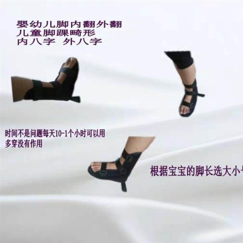 现货速发婴儿腿型矫正器新生儿童内八字足内翻足外翻o型腿固定矫