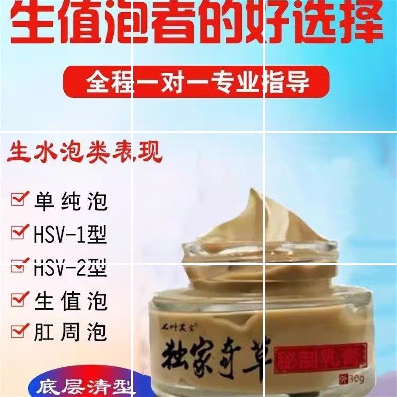 反覆型生值泡单纯疹HSV1型HSV2型用