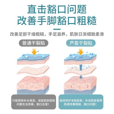 江皇一次性倒刺手足芦荟干裂贴学生护理温和改善粗糙豁口胶布独立