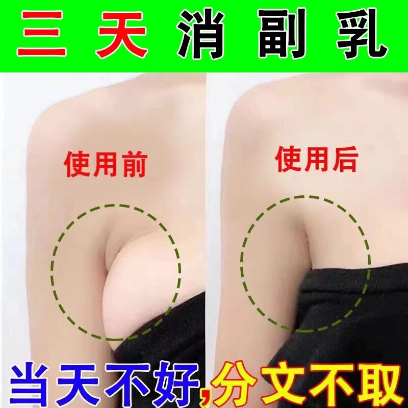 速发【当效见晚】腋下淋结疏通药膏贴淋巴结肿散巴贴膏去消副乳神