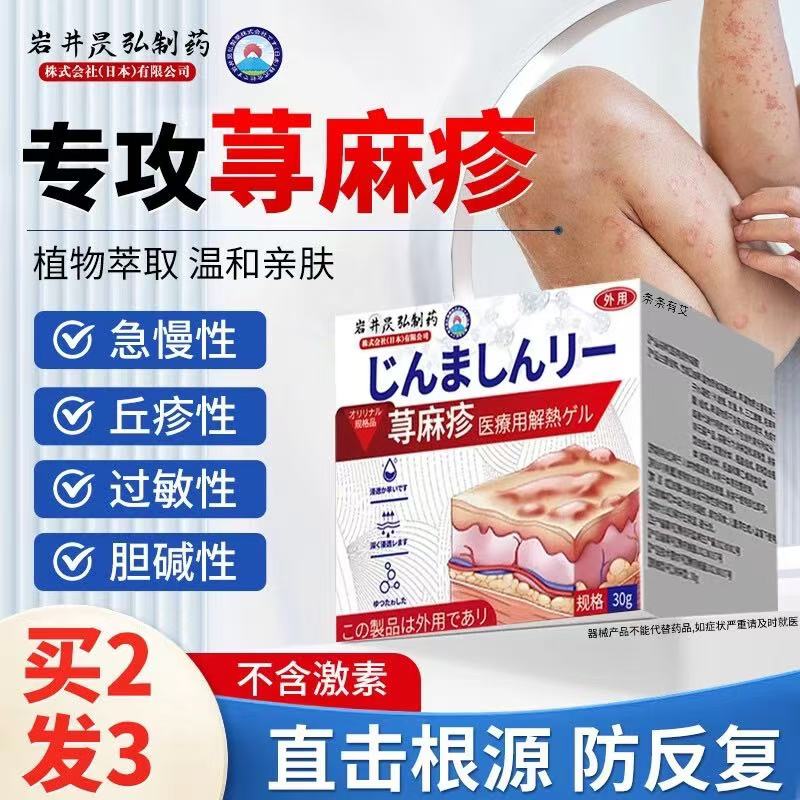 寻荨麻疹过敏止痒专用药止痒治疗荨麻疹的特效药荨麻疹药膏寻荨麻疹过敏止痒专用药