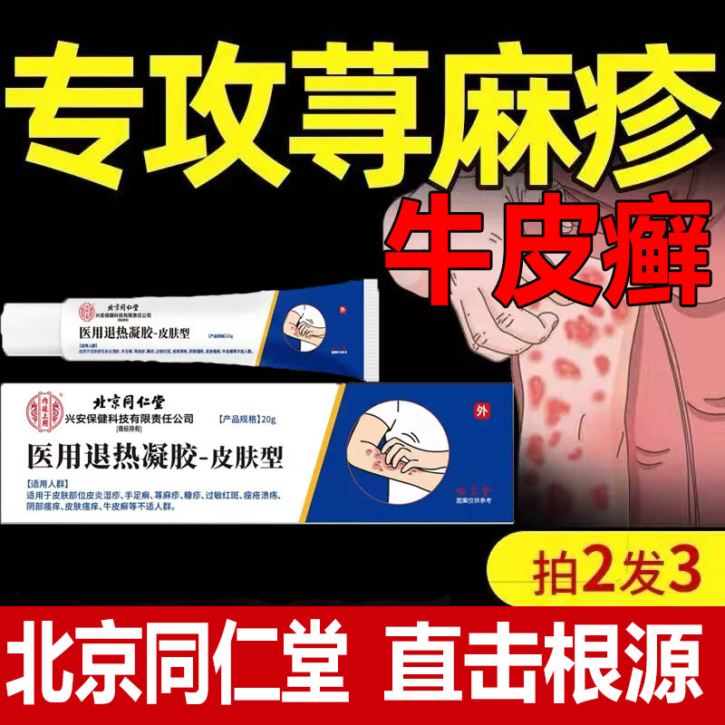 北京同仁堂皮肤瘙痒止痒外用的荨麻疹牛皮癣专用药膏寻荨麻疹过敏止痒断根专用药治疗荨麻疹的特效药荨麻疹药膏银屑病专用药