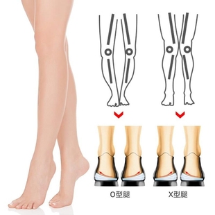 纠正垫内八鞋垫改善腿型外侧小腿成人腿矫正O型磨损直腿神器外翻