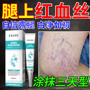 腿上有红血丝静脉曲张腿部毛细血管扩张青筋凸起专用膏药凝胶xu