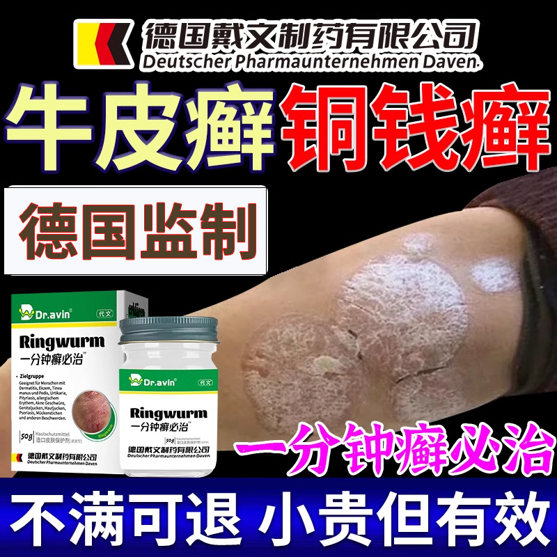 德国铜钱癣牛皮体癣止皮肤瘙痒抑菌专用膏正品可搭配皮癣净药膏xu
