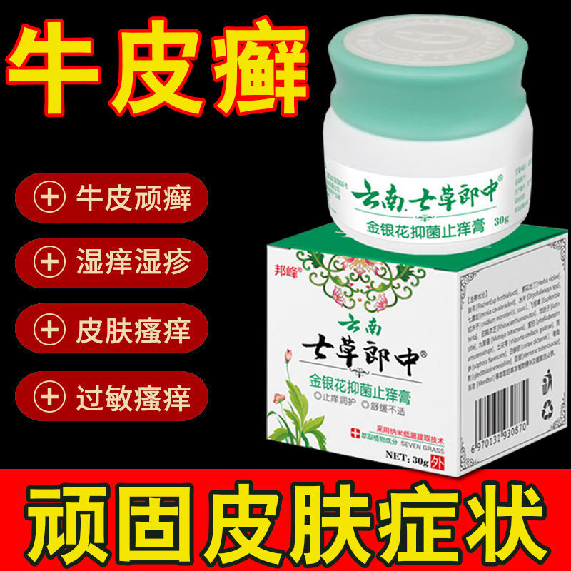 现货荨麻疹过敏止痒断药膏去慢急性断本草皮肤瘙痒寻荨麻疹药膏