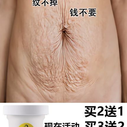 速发去除妊娠纹修复霜产后消除祛肥胖妊辰生长纹紧致孕妇专用预防